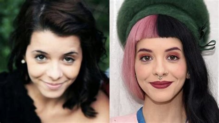 Melanie Martinez Plastic Surgery: A Comprehensive Analysis